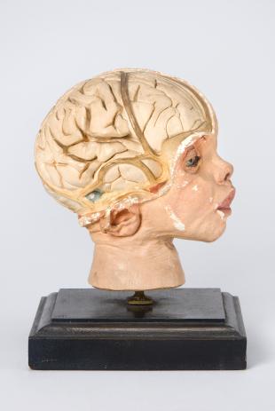 model of the head of a six month-old child, brain exposed on the righthand side