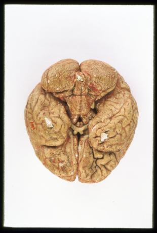 model of the brain